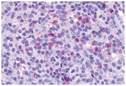 CCRL2 Rabbit anti-Human, Polyclonal Antibody, Abnova 50 &mu;g | Buy Online | Abnova Corporation | Fisher Scientific