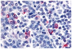 CXCR6 Rabbit anti-Human, Monkey, Polyclonal Antibody, Abnova 50&mu;g; Unlabeled:Antibodies,