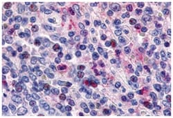 CCR1 Rabbit anti-Human, Polyclonal Antibody, Abnova 50 &mu;g | Buy Online | Abnova Corporation | Fisher Scientific