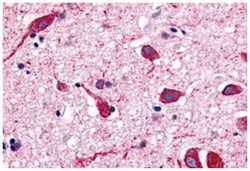 CHRM2 Rabbit anti-Bovine, Dog, Guinea pig, Hamster, Human, Monkey, Mouse, Pig, Rabbit, Rat, Sheep, Polyclonal Antibody, Abnova 50 &mu;g | Buy Online | Abnova Corporation | Fisher Scientific