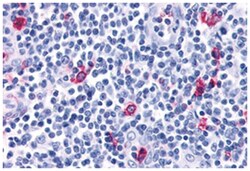 Rabbit anti-CXCR3, Polyclonal, Abnova 50&mu;g; Unlabeled:Antibodies, Polyclonal