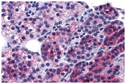 CASR Rabbit anti-Human, Polyclonal Antibody, Abnova 50 &mu;g | Buy Online | Abnova Corporation | Fisher Scientific