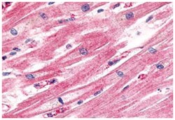 CCRL1 Rabbit anti-Dog, Horse, Human, Mouse, Pig, Rabbit, Rat, Polyclonal