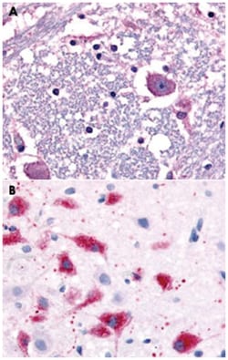 CRHR1 Rabbit anti-Human, Monkey, Rat, Polyclonal Antibody, Abnova 50 &mu;g | Buy Online | Abnova Corporation | Fisher Scientific