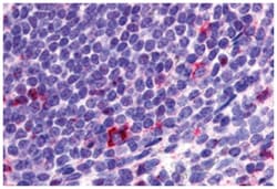 CCR2 Rabbit anti-Human, Monkey, Polyclonal Antibody, Abnova 50 &mu;g | Buy Online | Abnova Corporation | Fisher Scientific