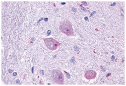 CHRM4, Rabbit, Polyclonal Antibody, Abnova 50 &mu;g | Buy Online | Abnova Corporation | Fisher Scientific