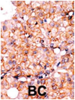AKT1 (phospho S129), Rabbit anti-Human, Polyclonal Antibody, Abnova 400 &mu;L | Buy Online | Abnova Corporation | Fisher Scientific