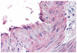 CCR1 Rabbit anti-Human, Polyclonal Antibody, Abnova 50 &mu;g | Buy Online | Abnova Corporation | Fisher Scientific