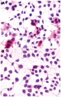 CNR1 Rabbit anti-Bovine, Dog, Horse, Human, Monkey, Mouse, Pig, Rat, Polyclonal Antibody, Abnova 50 &mu;g | Buy Online | Abnova Corporation | Fisher Scientific