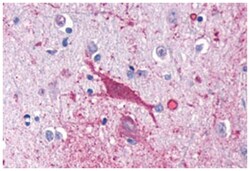 CNR1 Rabbit anti-Bovine, Dog, Horse, Human, Monkey, Mouse, Pig, Rat, Polyclonal Antibody, Abnova 50 &mu;g | Buy Online | Abnova Corporation | Fisher Scientific