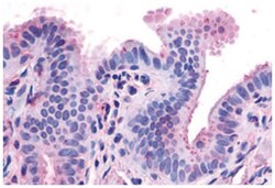 CCKAR Rabbit anti-Human, Polyclonal Antibody, Abnova 50&mu;g; Unlabeled:Antibodies,