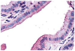 CCKAR Rabbit anti-Human, Polyclonal Antibody, Abnova 50 &mu;g | Buy Online | Abnova Corporation | Fisher Scientific