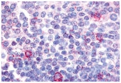CNR2 Rabbit anti-Human, Polyclonal Antibody, Abnova 50 &mu;g | Buy Online | Abnova Corporation | Fisher Scientific