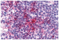 CCR6 Rabbit anti-Human, Polyclonal Antibody, Abnova 50 &mu;g | Buy Online | Abnova Corporation | Fisher Scientific