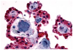 CRHR2 Rabbit anti-Human, Polyclonal Antibody, Abnova 50 &mu;g | Buy Online | Abnova Corporation | Fisher Scientific