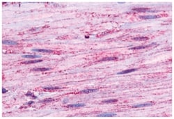 BDKRB1 Rabbit anti-Human, Monkey, Polyclonal Antibody, Abnova 50 &mu;g | Buy Online | Abnova Corporation | Fisher Scientific