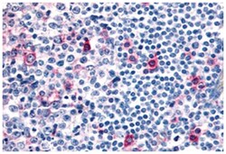 CCR8 Rabbit anti-Human, Polyclonal Antibody, Abnova 50 &mu;g | Buy Online | Abnova Corporation | Fisher Scientific