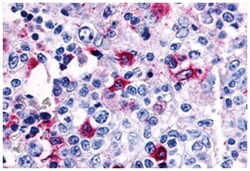 CCR8 Rabbit anti-Human, Polyclonal Antibody, Abnova 50&mu;g; Unlabeled:Antibodies,