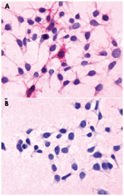 C5AR1 Rabbit anti-Human, Polyclonal Antibody, Abnova 50&mu;g; Unlabeled:Antibodies,