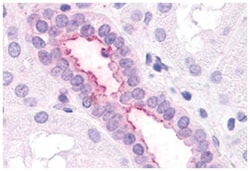 CXCR2 Rabbit anti-Human, Polyclonal Antibody, Abnova 50 &mu;g | Buy Online | Abnova Corporation | Fisher Scientific
