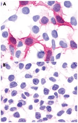 CXCR1 Rabbit anti-Human, Polyclonal Antibody, Abnova 50 &mu;g | Buy Online | Abnova Corporation | Fisher Scientific