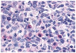 CXCR1 Rabbit anti-Human, Polyclonal Antibody, Abnova 50 &mu;g | Buy Online | Abnova Corporation | Fisher Scientific