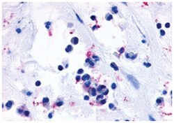 CYSLTR1 Rabbit anti-Human, Monkey, Polyclonal Antibody, Abnova 50 &mu;g | Buy Online | Abnova | Fisher Scientific