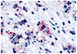 CYSLTR1 Rabbit anti-Human, Polyclonal Antibody, Abnova 50 &mu;g | Buy Online | Abnova Corporation | Fisher Scientific