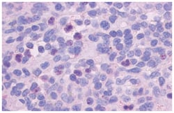 FPR1 Rabbit anti-Human, Monkey, Polyclonal Antibody, Abnova 50 &mu;g | Buy Online | Abnova Corporation | Fisher Scientific
