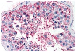 FSHR, Rabbit, Polyclonal Antibody, Abnova 50&mu;g; Unlabeled:Antibodies,