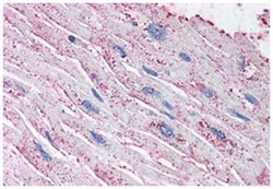 EDNRA Rabbit anti-Human, Polyclonal Antibody, Abnova 50 &mu;g | Buy Online | Abnova Corporation | Fisher Scientific