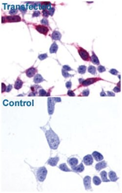 FZD6, Rabbit, Polyclonal Antibody, Abnova 50 &mu;g | Buy Online | Abnova Corporation | Fisher Scientific
