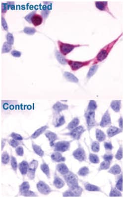 EDNRB Rabbit anti-Dog, Human, Polyclonal Antibody, Abnova 50 &mu;g | Buy Online | Abnova Corporation | Fisher Scientific