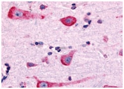 DRD2 Rabbit anti-Human, Polyclonal Antibody, Abnova 50 &mu;g | Buy Online | Abnova Corporation | Fisher Scientific