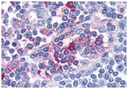 FPR1 Rabbit anti-Human, Polyclonal Antibody, Abnova 50 &mu;g | Buy Online | Abnova Corporation | Fisher Scientific