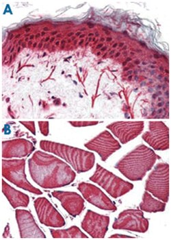 FZD3 Rabbit anti-Bovine, Chicken, Dog, Hamster, Horse, Human, Monkey, Mouse, Pig, Rabbit, Rat, Polyclonal Antibody, Abnova 50 &mu;g | Buy Online | Abnova Corporation | Fisher Scientific