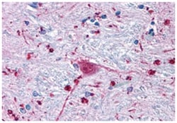FZD3 Rabbit anti-Bovine, Dog, Hamster, Horse, Human, Monkey, Mouse, Pig, Rabbit, Rat, Polyclonal Antibody, Abnova 50 &mu;g | Buy Online | Abnova Corporation | Fisher Scientific