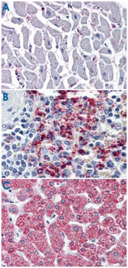CYSLTR2 Rabbit anti-Human, Polyclonal Antibody, Abnova 50 &mu;g | Buy Online | Abnova Corporation | Fisher Scientific