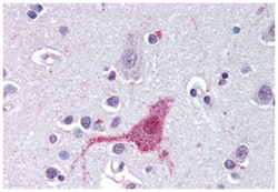 EDNRB Rabbit anti-Dog, Human, Polyclonal Antibody, Abnova 50&mu;g; Unlabeled:Antibodies,
