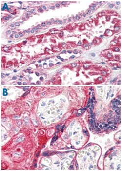 PTGER2 Rabbit anti-Human, Polyclonal Antibody, Abnova 50&mu;g; Unlabeled:Antibodies,