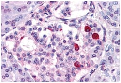 GIPR Rabbit anti-Human, Polyclonal Antibody, Abnova 50 &mu;g | Buy Online | Abnova Corporation | Fisher Scientific
