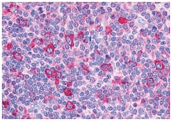 GPR132 Rabbit anti-Human, Polyclonal Antibody, Abnova 50 &mu;g | Buy Online | Abnova | Fisher Scientific