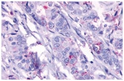 GPR124 Rabbit anti-Dog, Horse, Human, Monkey, Pig, Rabbit, Polyclonal Antibody, Abnova 50 &mu;g | Buy Online | Abnova Corporation | Fisher Scientific