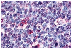 GPR146 Rabbit anti-Hamster, Human, Mouse, Rat, Polyclonal Antibody, Abnova 50 &mu;g | Buy Online | Abnova Corporation | Fisher Scientific