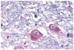 PTH2R Rabbit anti-Human, Polyclonal Antibody, Abnova 50&mu;g; Unlabeled:Antibodies,