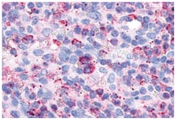 P2RY6 Rabbit anti-Bovine, Hamster, Human, Monkey, Pig, Rabbit, Rat, Polyclonal Antibody, Abnova 50 &mu;g | Buy Online | Abnova Corporation | Fisher Scientific
