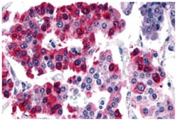 SSTR4, Rabbit, Polyclonal Antibody, Abnova 50 &mu;g | Buy Online | Abnova Corporation | Fisher Scientific