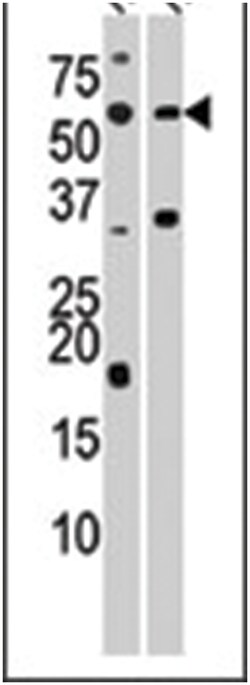 ACVR1C, Rabbit, Polyclonal Antibody, Abnova 400 &mu;L | Buy Online | Abnova Corporation | Fisher Scientific