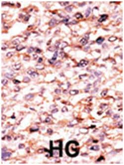 ACVR1C, Rabbit, Polyclonal Antibody, Abnova 400 &mu;L | Buy Online | Abnova Corporation | Fisher Scientific