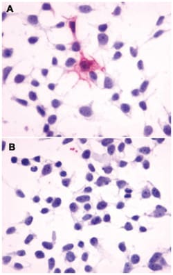 MC4R Rabbit anti-Horse, Human, Monkey, Polyclonal Antibody, Abnova 50 &mu;g | Buy Online | Abnova Corporation | Fisher Scientific